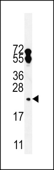 FAM96A Antibody