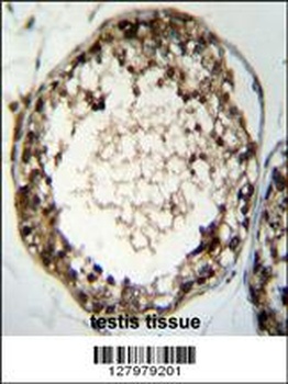 TSSK4 Antibody