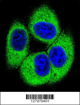 TSSK4 Antibody