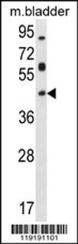 HOXD13 Antibody