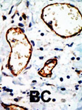 NCOR1 Antibody