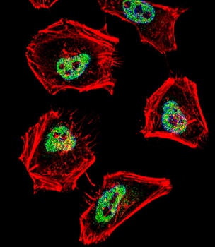 NCOR1 Antibody