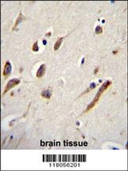 FBXW11 Antibody