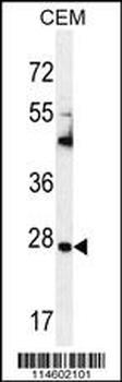 TIMP1 Antibody