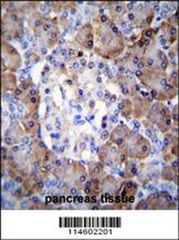 TIMP1 Antibody