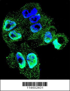 TIMP1 Antibody