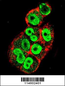 TIMP1 Antibody