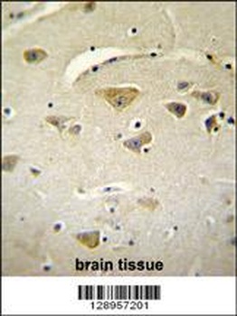 VSTM2A Antibody