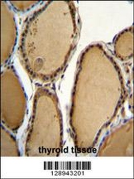 KLRAQ1 Antibody