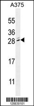 MBD3L2 Antibody