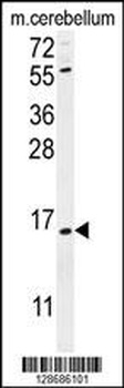ANR39 Antibody