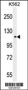 TDRD1 Antibody