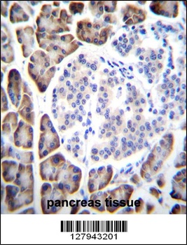 UROC1 Antibody