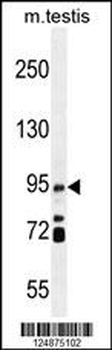 IFT88 Antibody