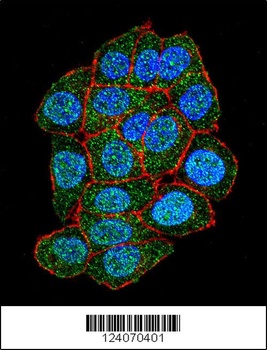 ASXL1 Antibody