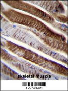 ETFA Antibody