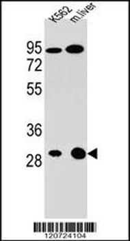 ETFA Antibody