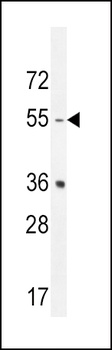 HTR2B Antibody