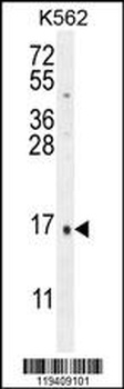 CALCA Antibody