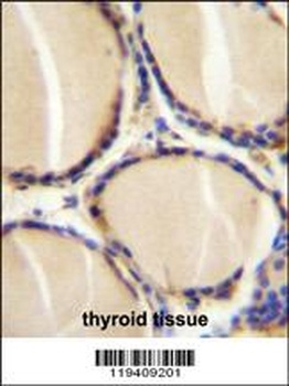 CALCA Antibody