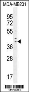 IRF1 Antibody