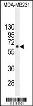 HNF1B Antibody