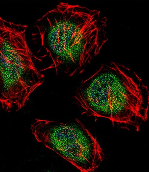 CNOT7 Antibody