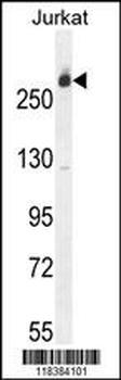 CAD Antibody