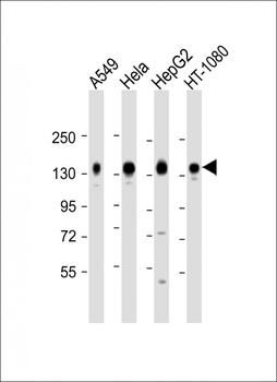 IL6ST Antibody