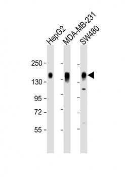 IL6ST Antibody