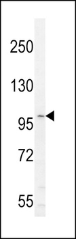 IL6ST Antibody