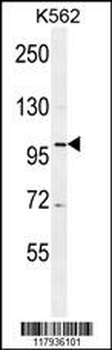 DDX27 Antibody