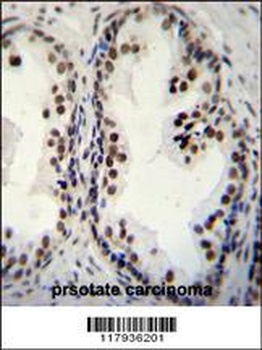DDX27 Antibody