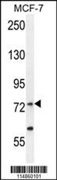 RARS Antibody