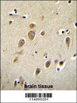 RARS Antibody