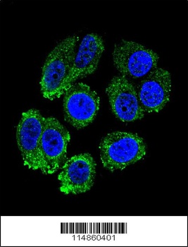 RARS Antibody