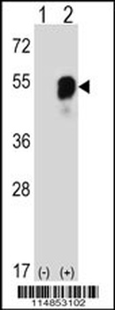 PARS2 Antibody