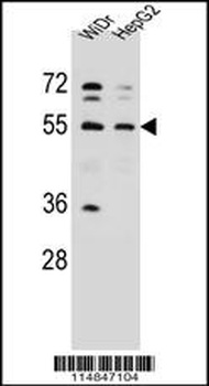 NARS Antibody