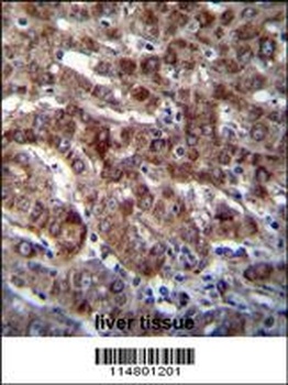 DARS Antibody