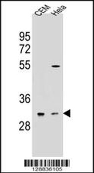 OR5L2 Antibody