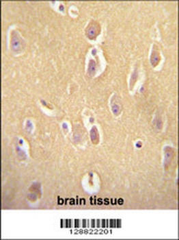 OR13J1 Antibody