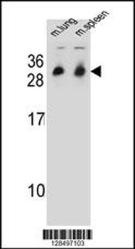 CYB561D1 Antibody