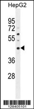 SATL1 Antibody