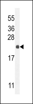 hCG_2024410 Antibody