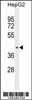 CCDC17 Antibody
