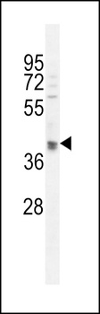 OTUD3 Antibody