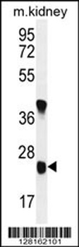 UNC119B Antibody