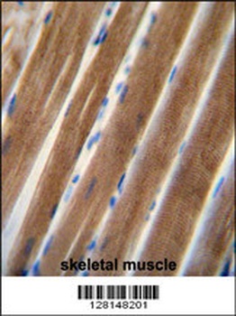 TNIP1 Antibody