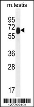 TTC39B Antibody
