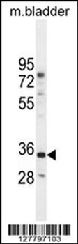 C17orf59 Antibody